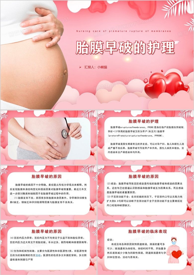 女性母婴母亲生产之胎膜早破的护理PPT模板