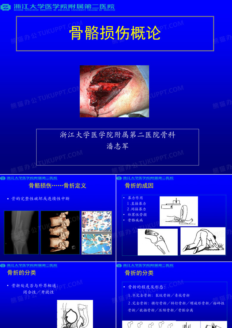 骨折概论-浙江大学