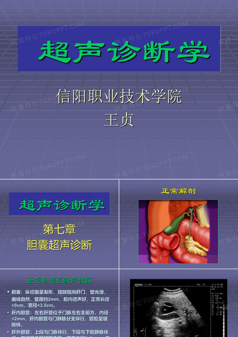 超声诊断学-胆囊超声诊断