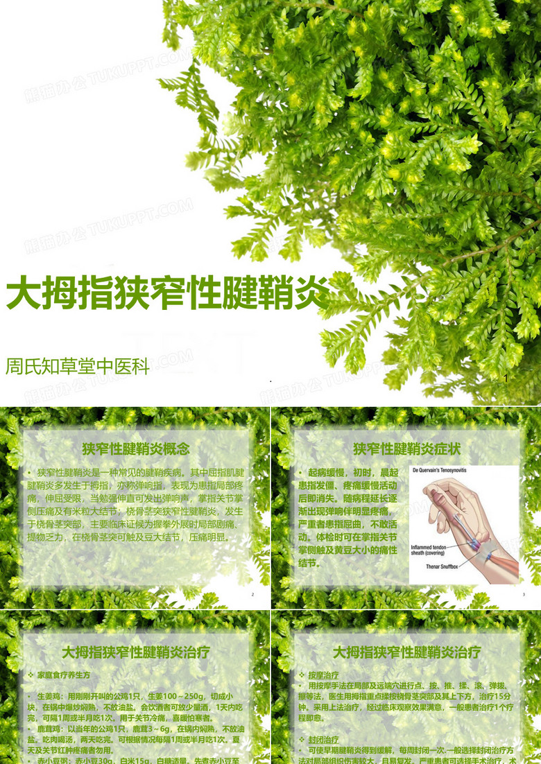 大拇指狭窄性腱鞘炎PPT课件