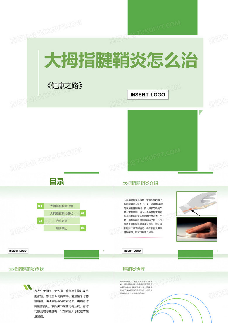 大拇指腱鞘炎怎么治ppt课件