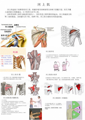 冈上肌解剖与痛点分析