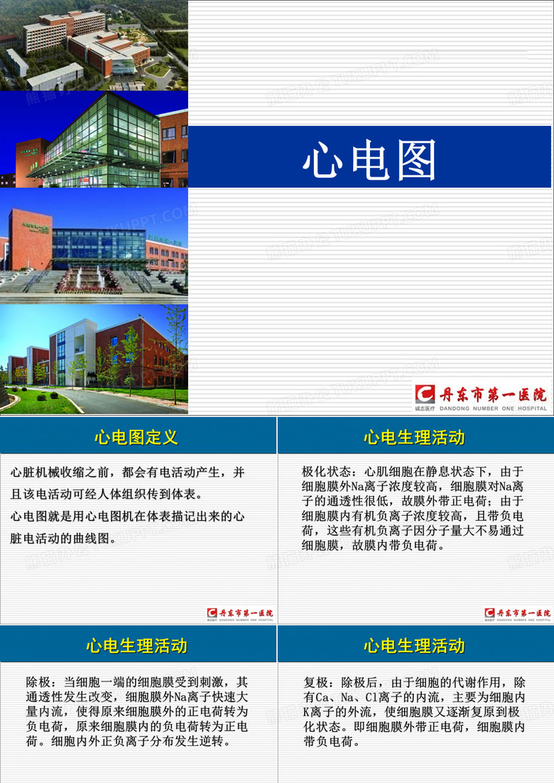 心电图