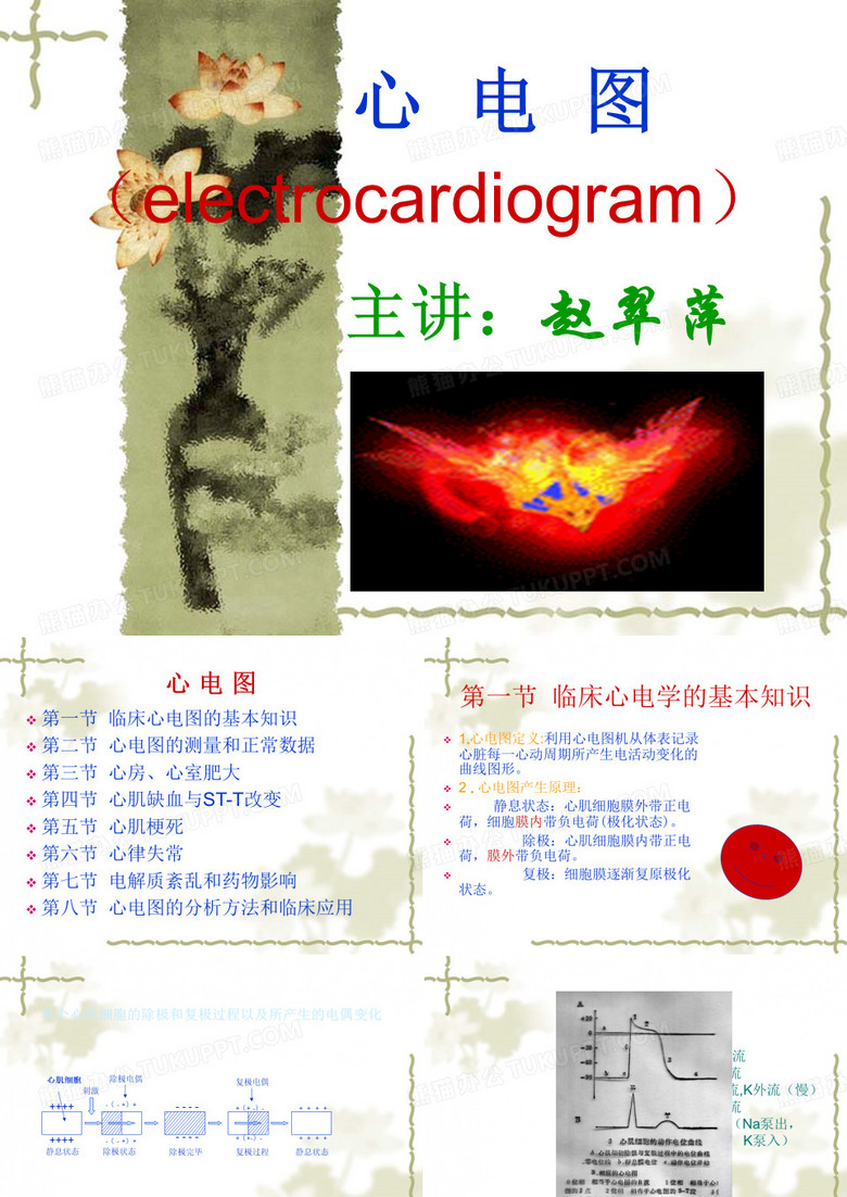 心电图