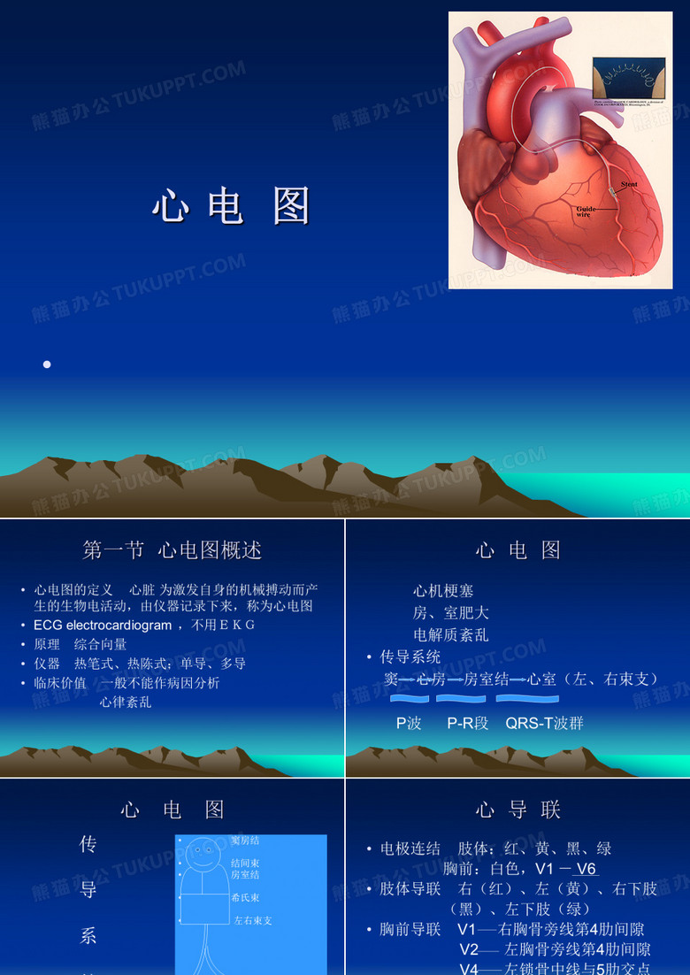 心电图