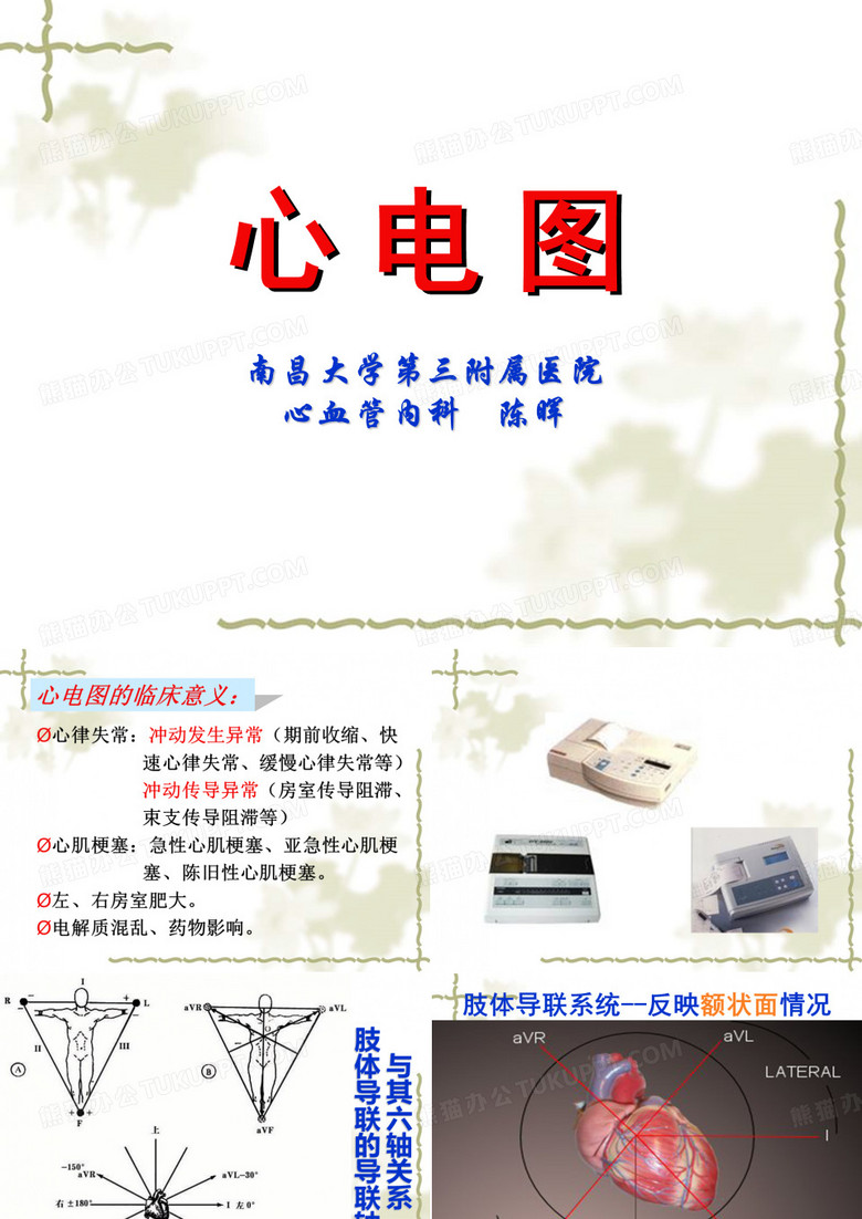 心电图