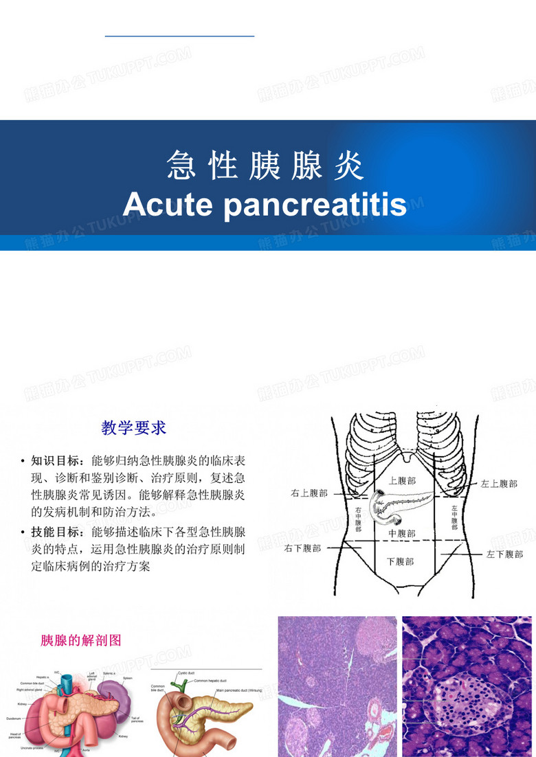 急性胰腺炎