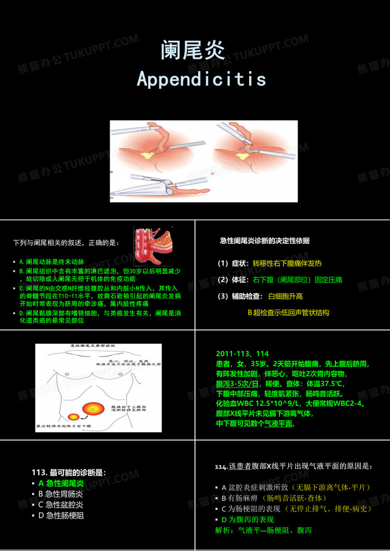 急性阑尾炎