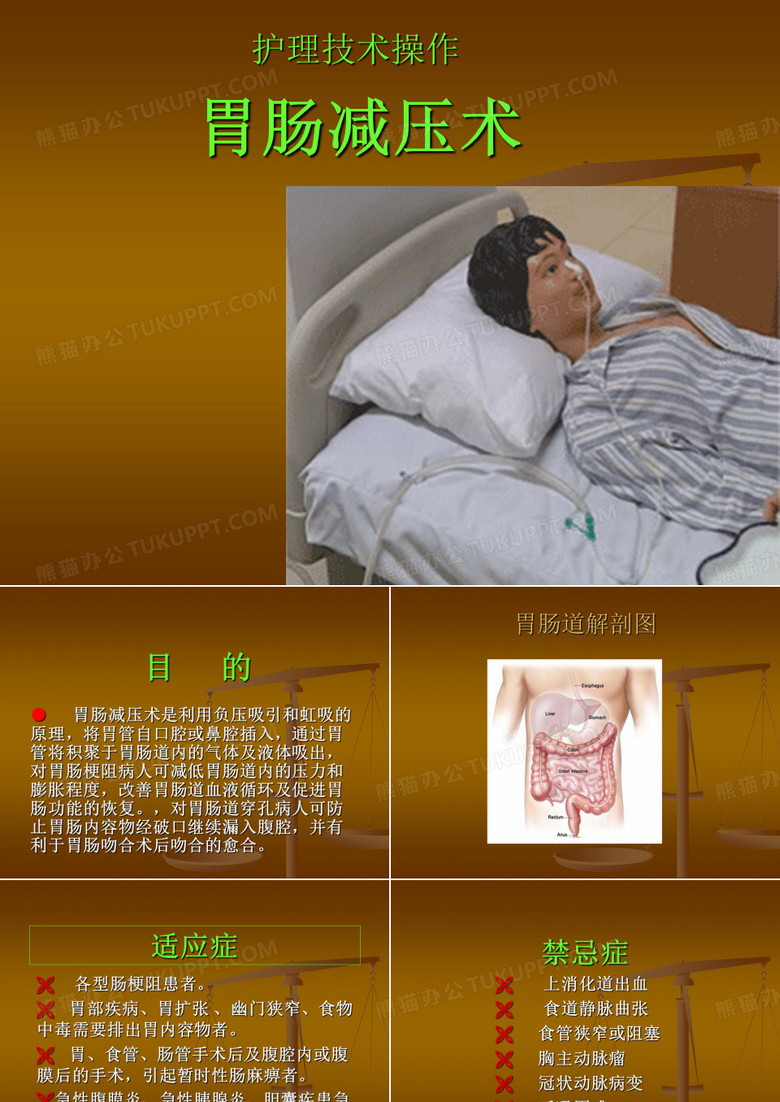 胃肠减压术