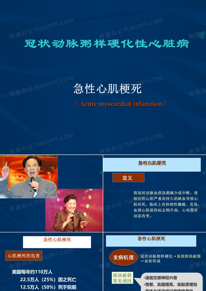 急性心肌梗死