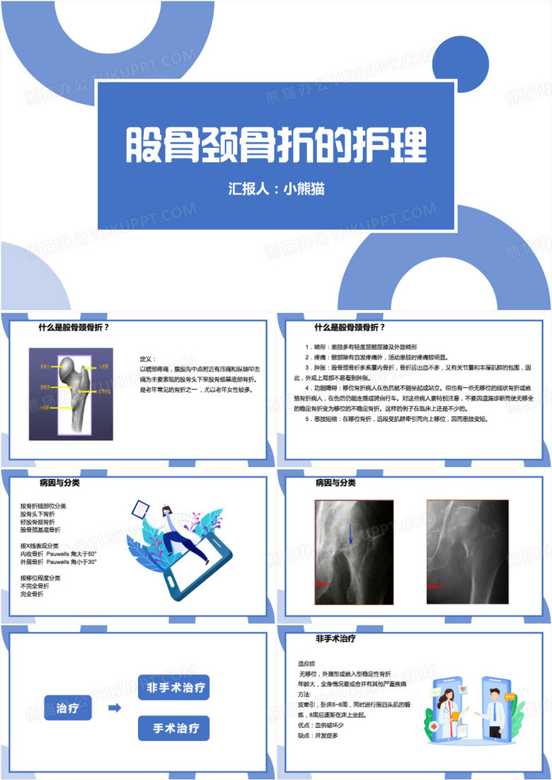 简约风股骨颈骨折护理查房PPT模板