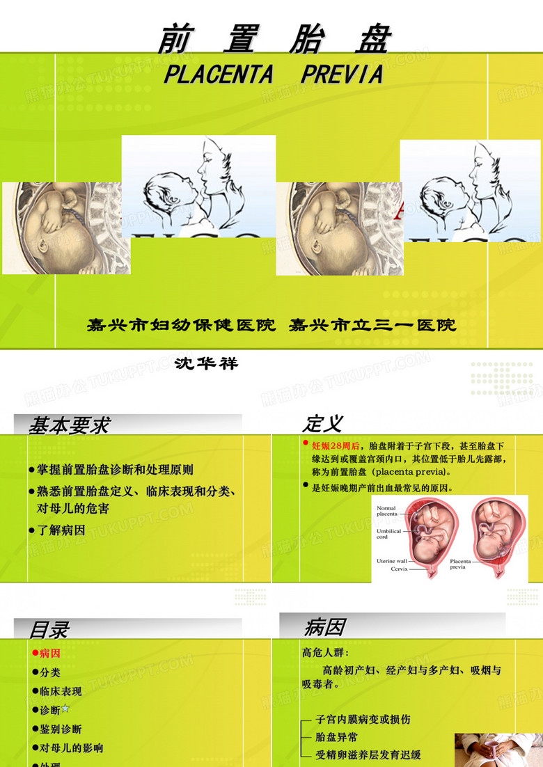 前置胎盘