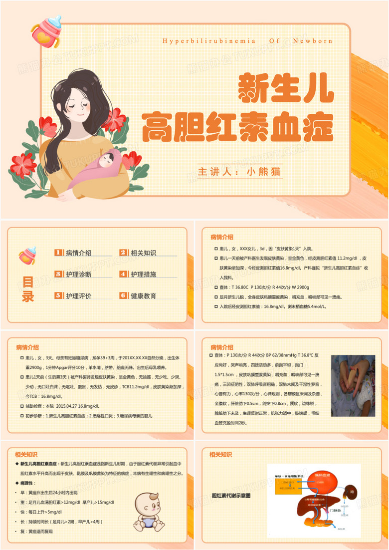 新生儿护理新生儿高胆红素血症PPT模板