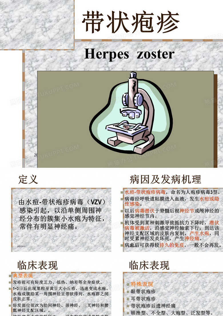 带状疱疹