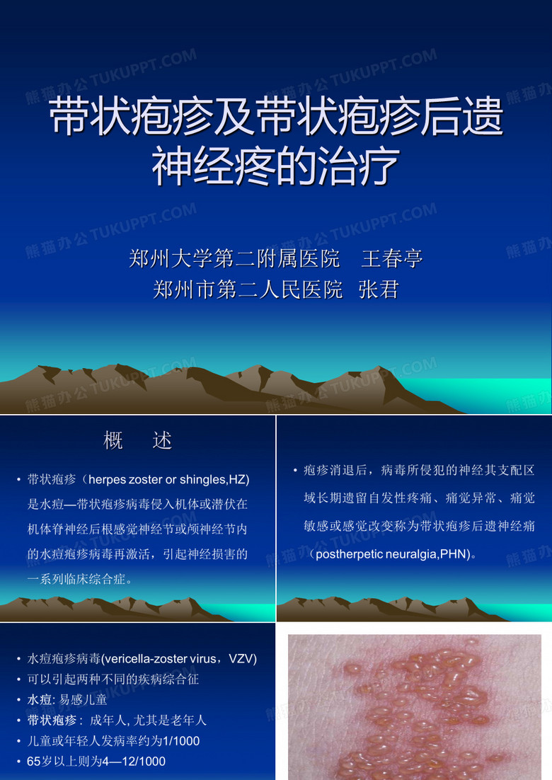 带状疱疹及带状疱疹后遗神经疼的治疗