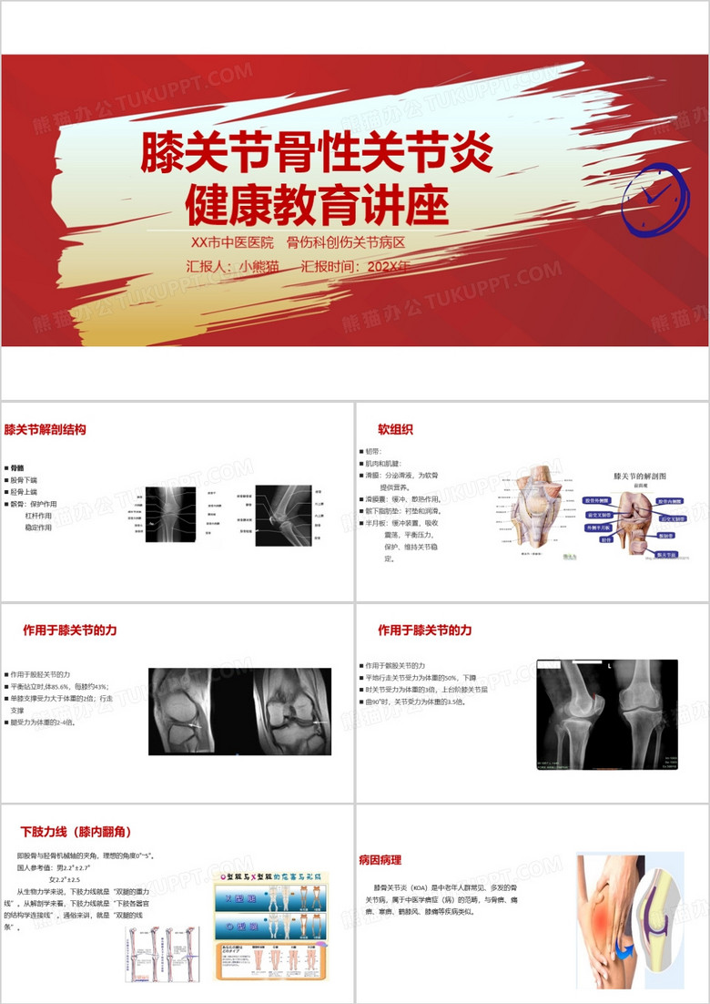 膝关节骨性关节炎健康教育讲座PPT模板