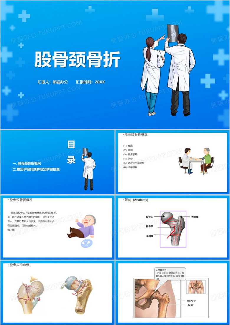 股骨颈骨折护理查房股骨颈骨折PPT模板