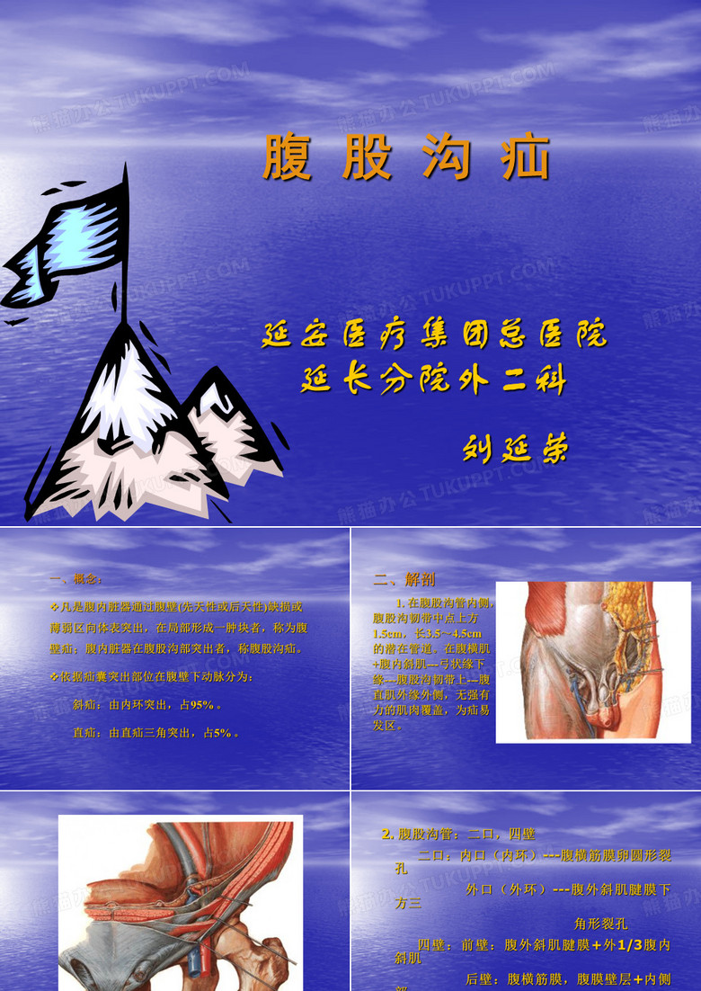 腹股沟疝