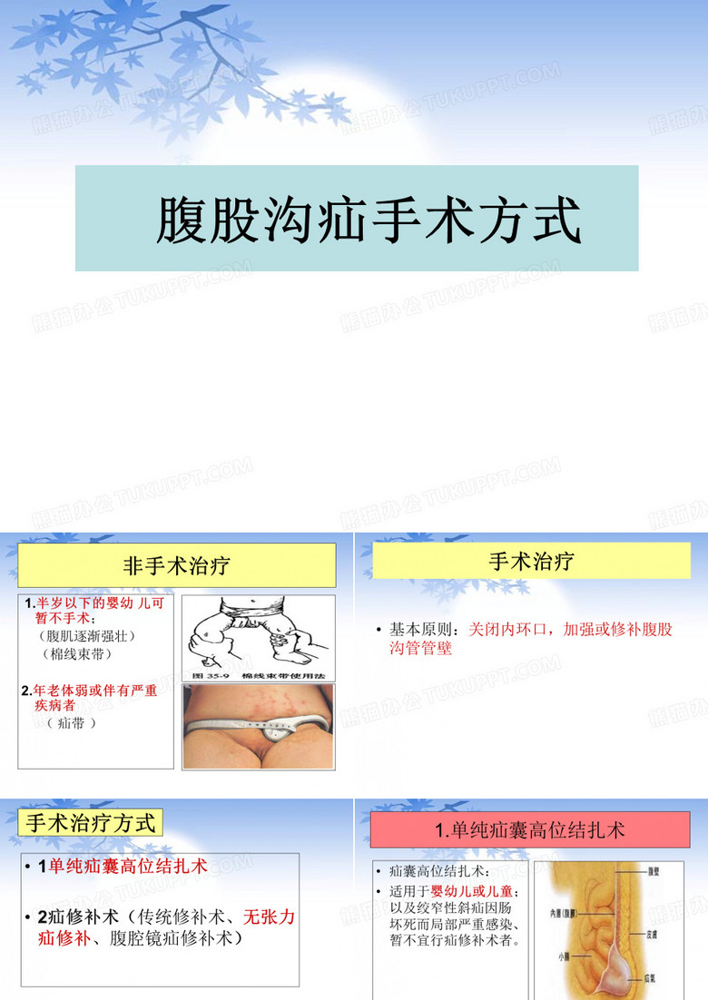 腹股沟疝手术