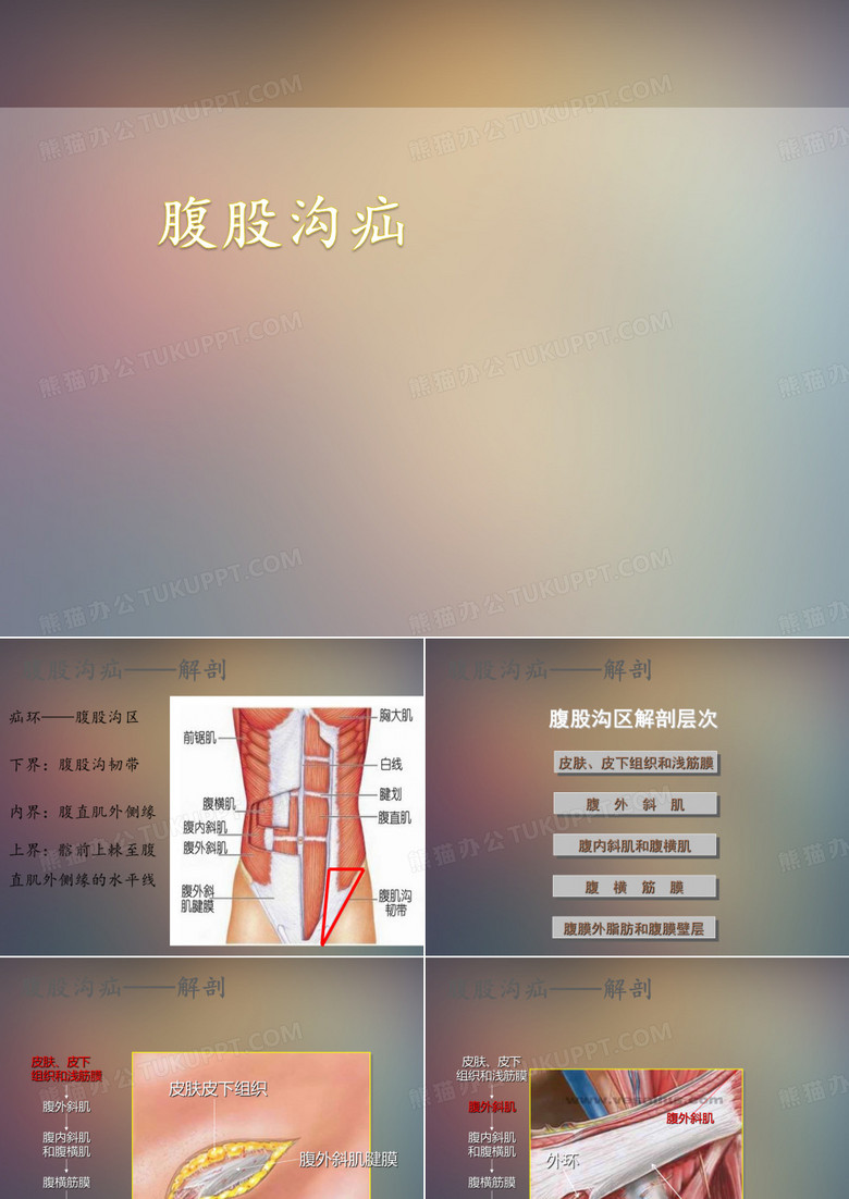 腹股沟疝 课件