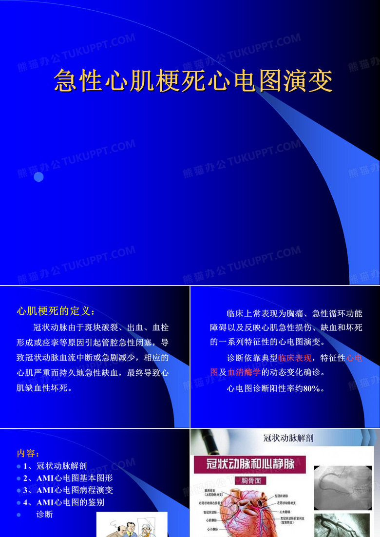 心肌梗塞