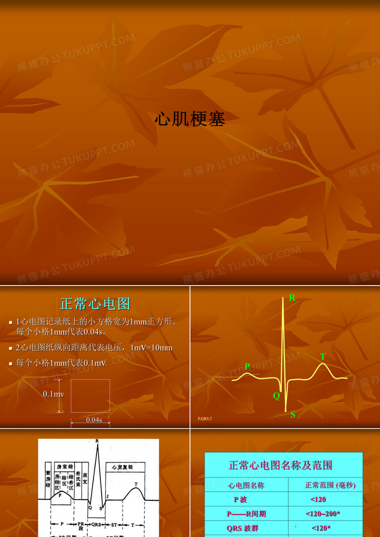 心肌梗塞