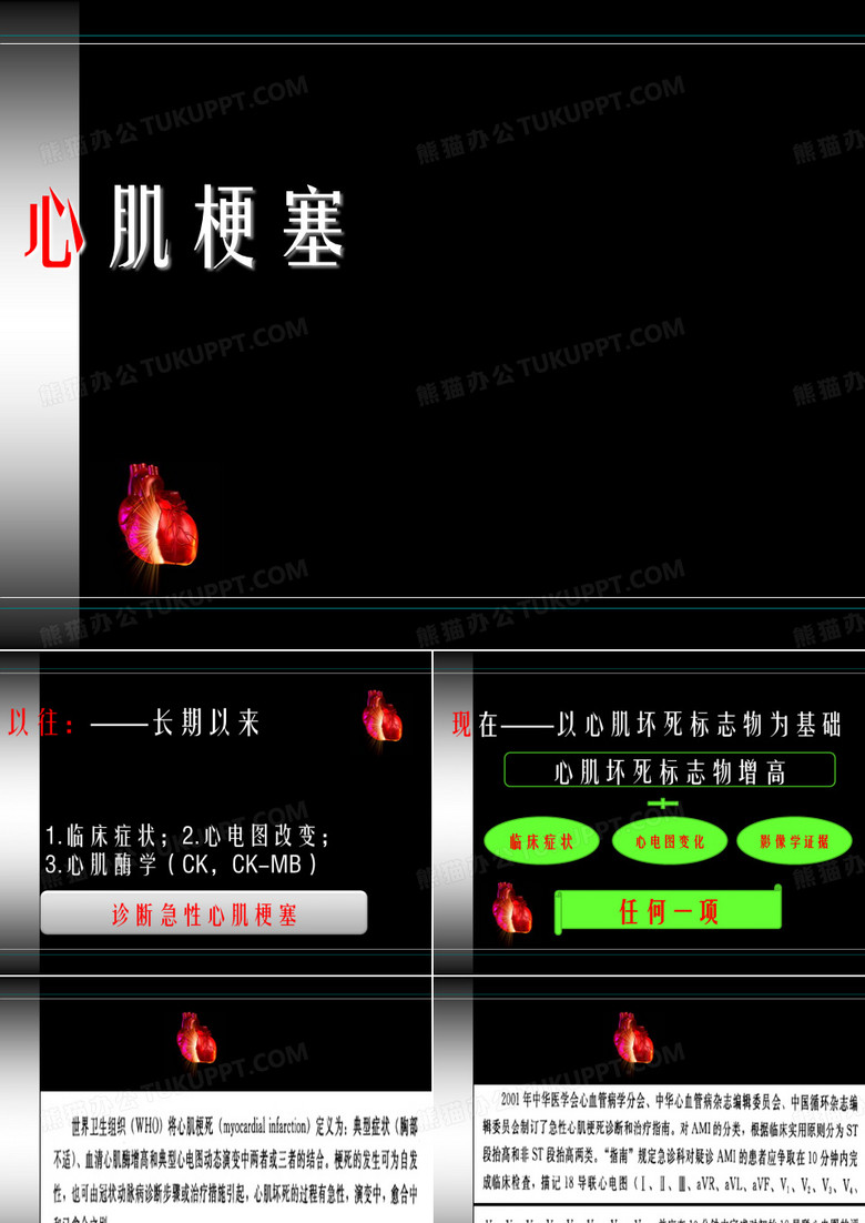 心肌梗塞ECG