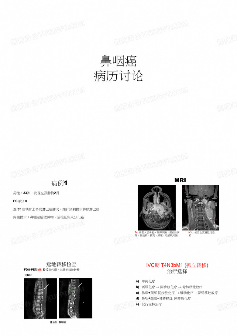 鼻咽癌病历讨论