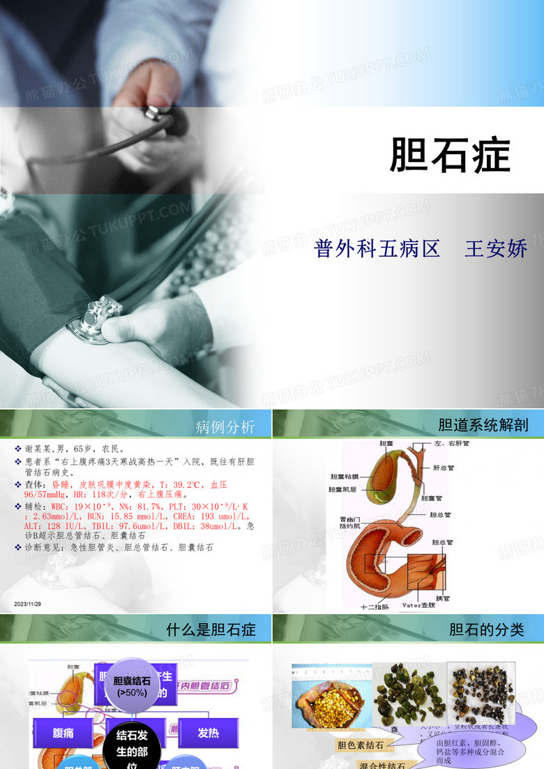 胆石症(2)