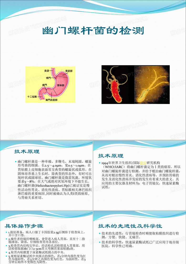 幽门螺杆菌的检测 