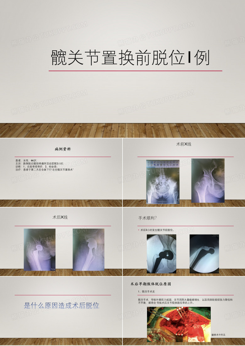 失败病例