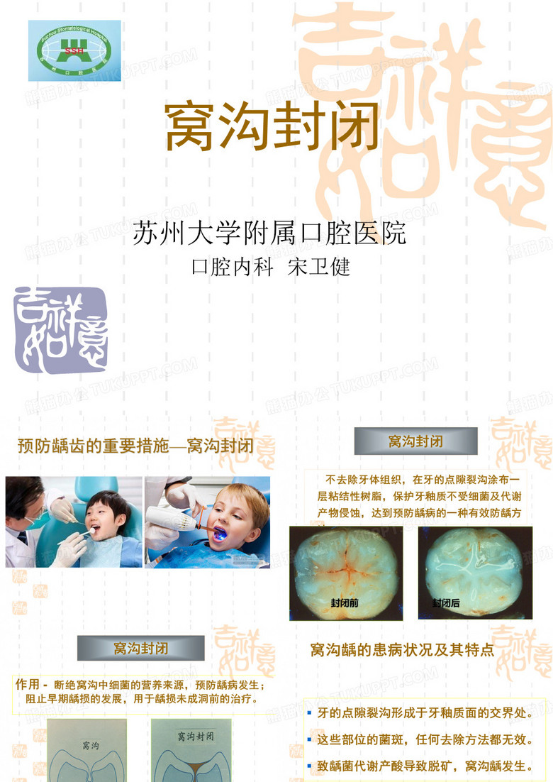 窝沟封闭