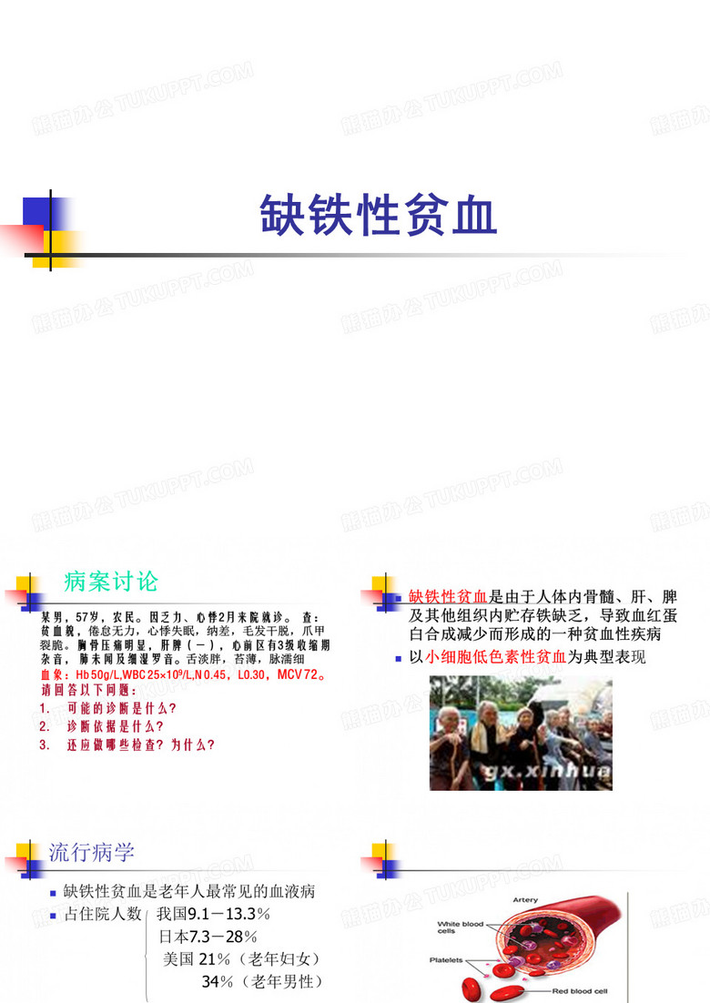 缺铁性贫血
