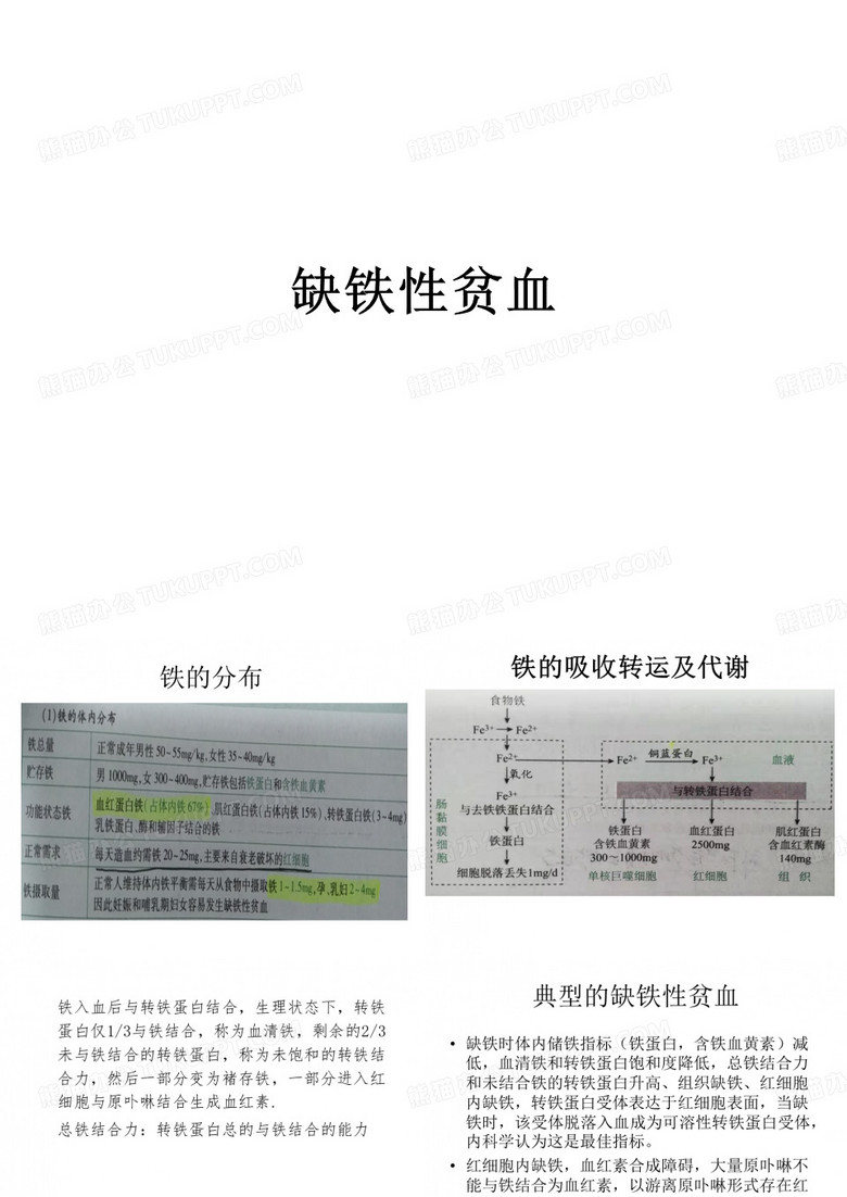 缺铁性贫血