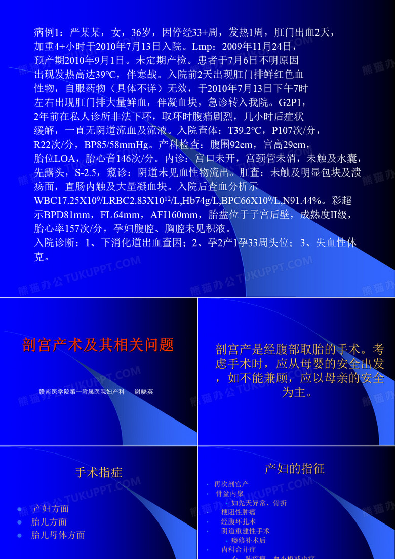剖宫产问题