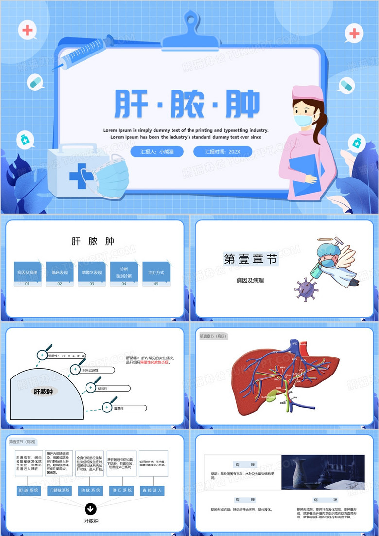 蓝色卡通风肝脓肿医学护理PPT模板