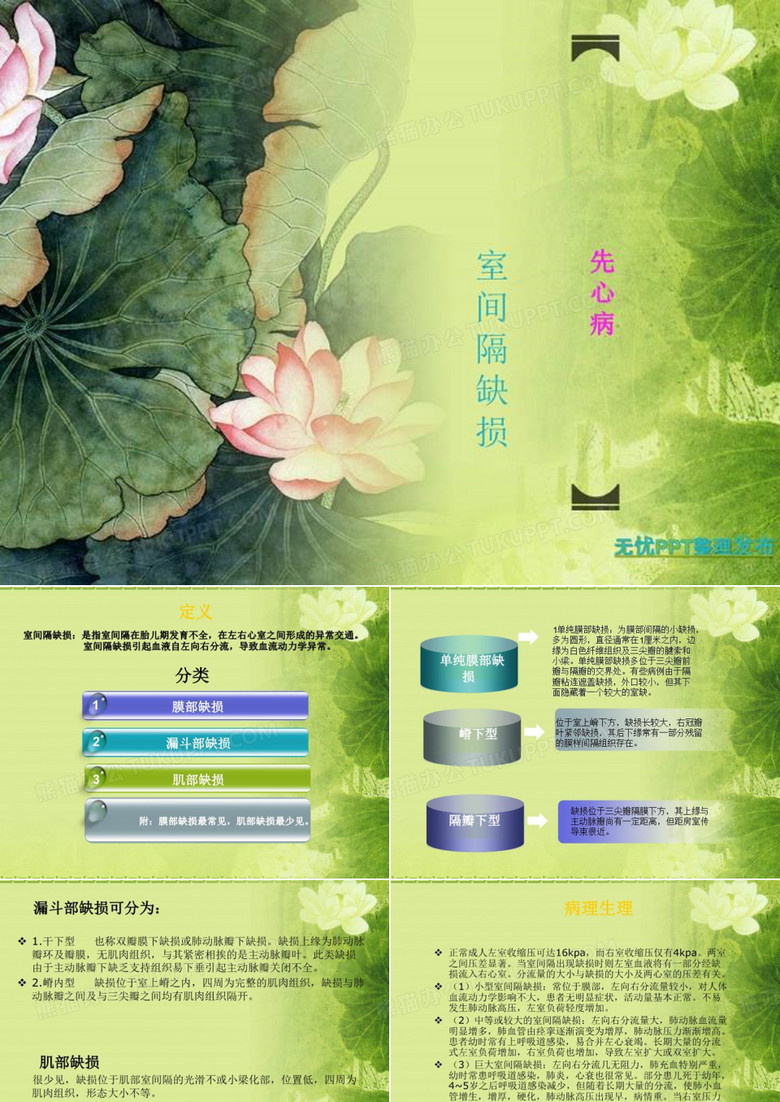 先心病：室间隔缺损