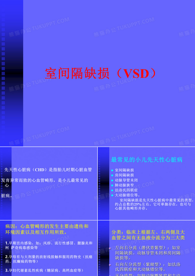室间隔缺损护理查房