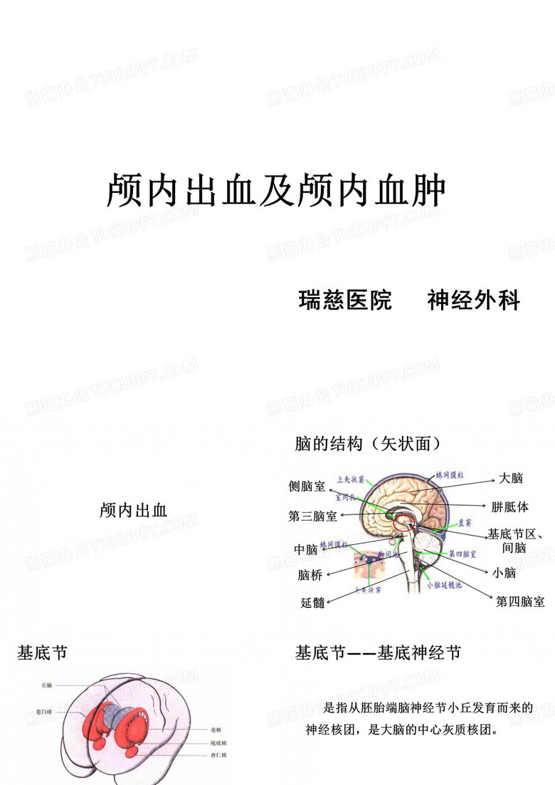 颅内出血与颅内血肿