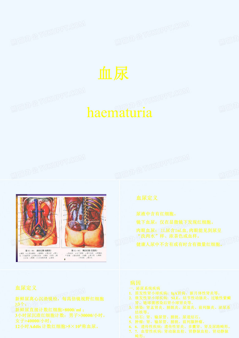 血尿.ppt