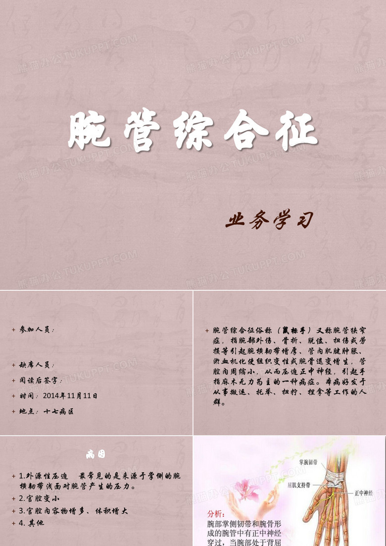 腕管综合征