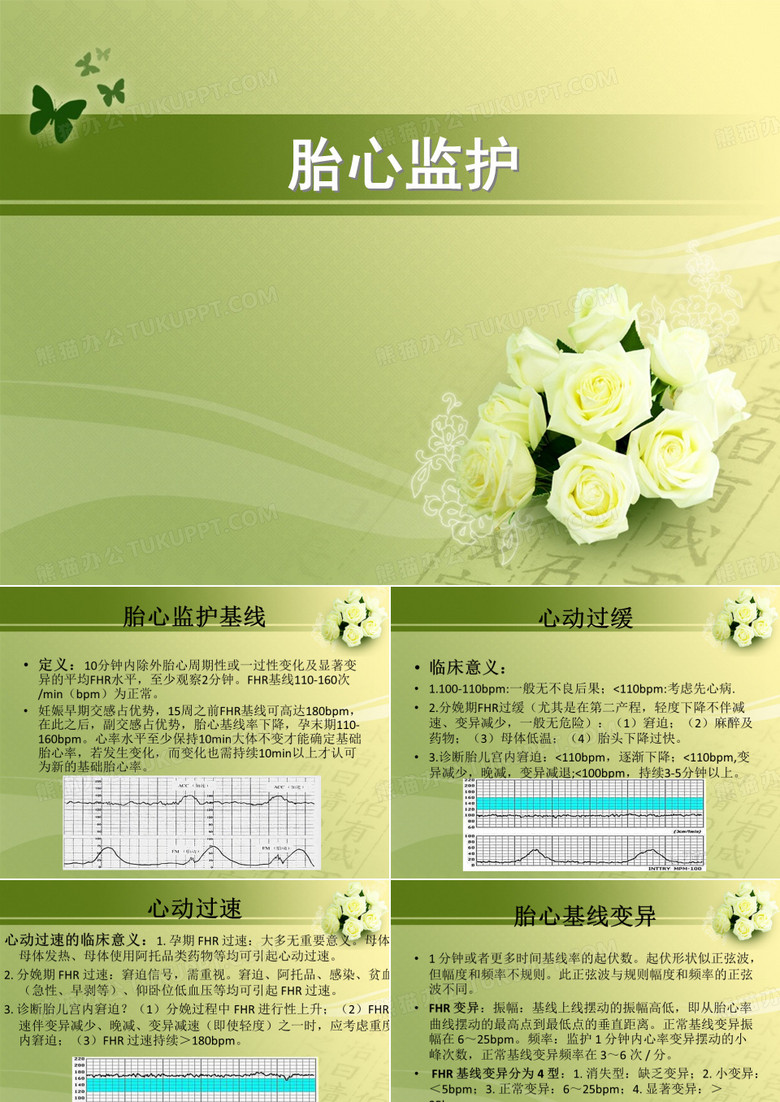 胎心监护