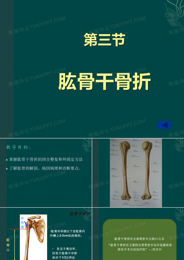 肱骨干骨折