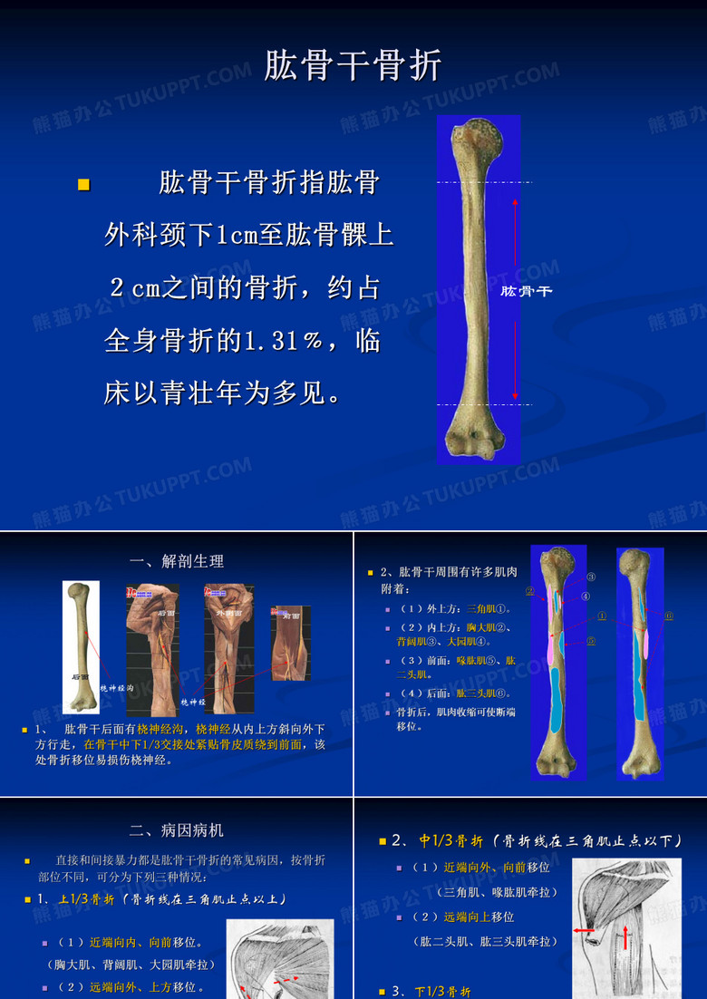 肱骨干骨折课件