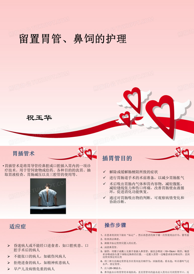 胃管留置