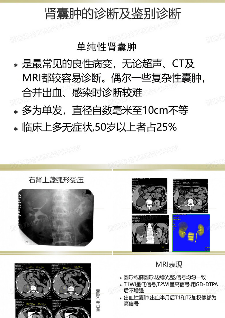 复杂性肾囊肿