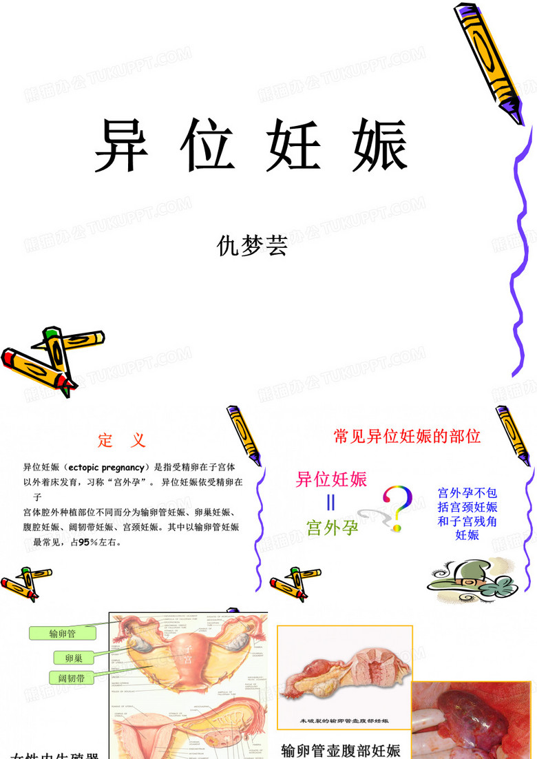 宫外孕