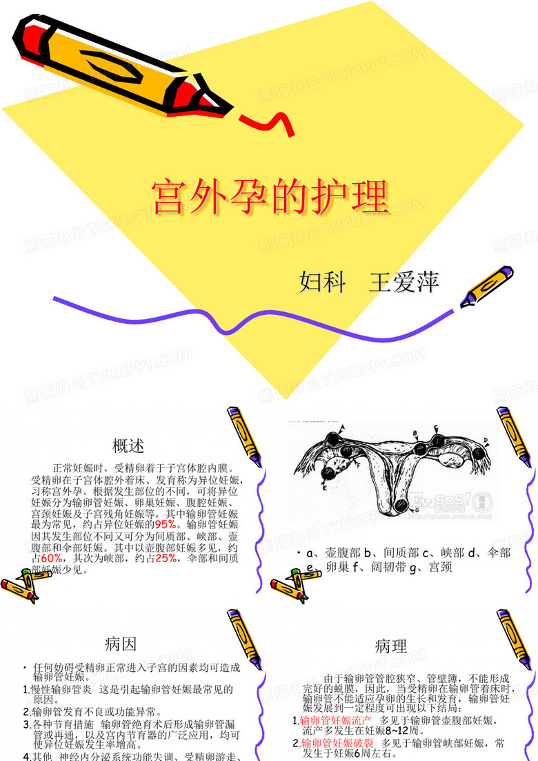 宫外孕的护理