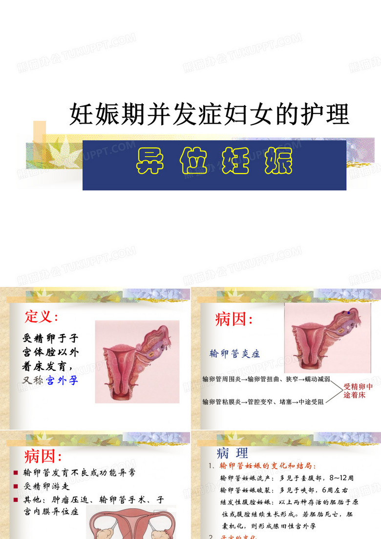 宫外孕的护理