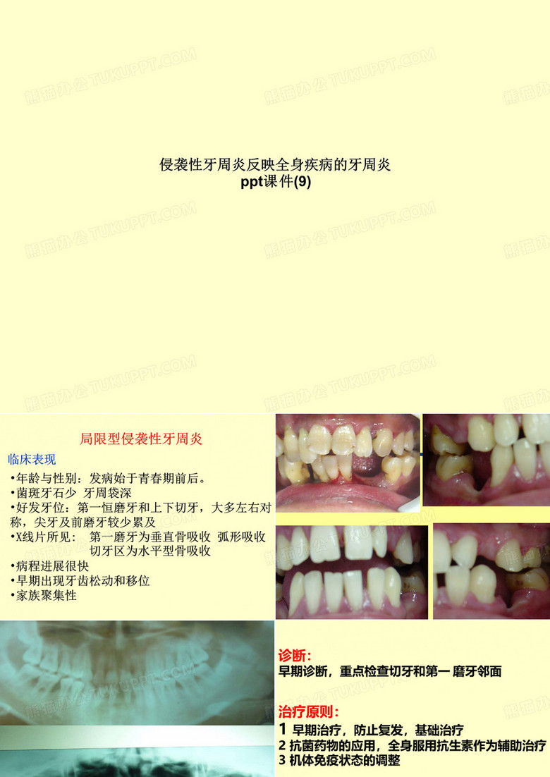 侵袭性牙周炎反映全身疾病的牙周炎